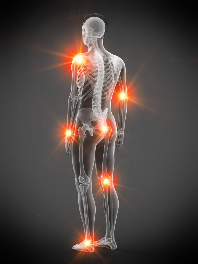 Anatomy TUESDAY – Clinical Anatomy Pearls 1 – Pain Referral Patterns