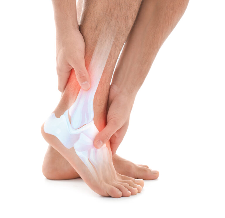 Kinesiology THURSDAY – Biomechanics of an Ankle Jam