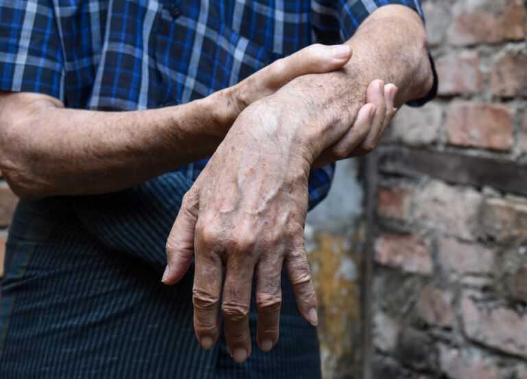 Anatomy TUESDAY – Radial Nerve