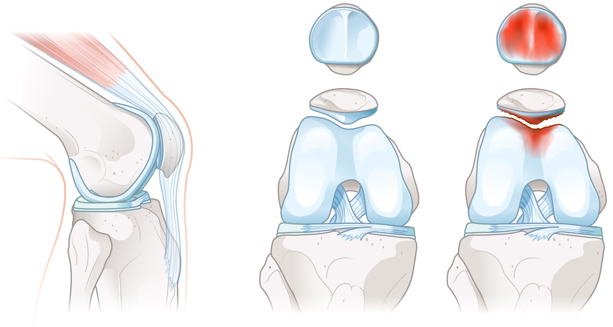 Anatomy Tuesday – Picking Apart the Patella – Movewell Academy