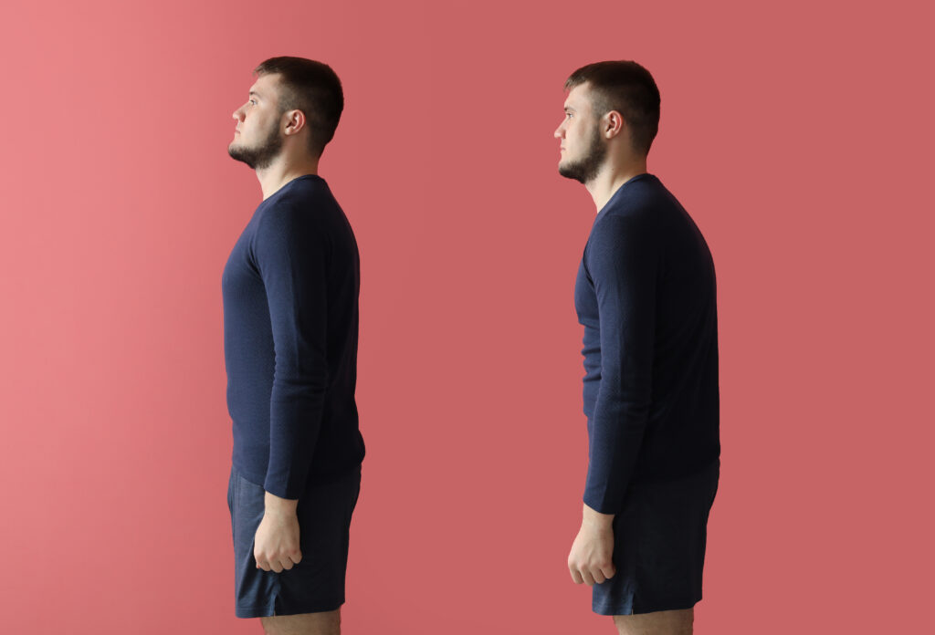 Man demonstrating good and poor posture.