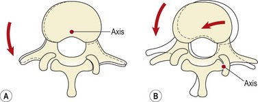Axis vertebrae motion diagrams with red arrows.