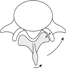 Diagram of spinal vertebrae with movement arrows.