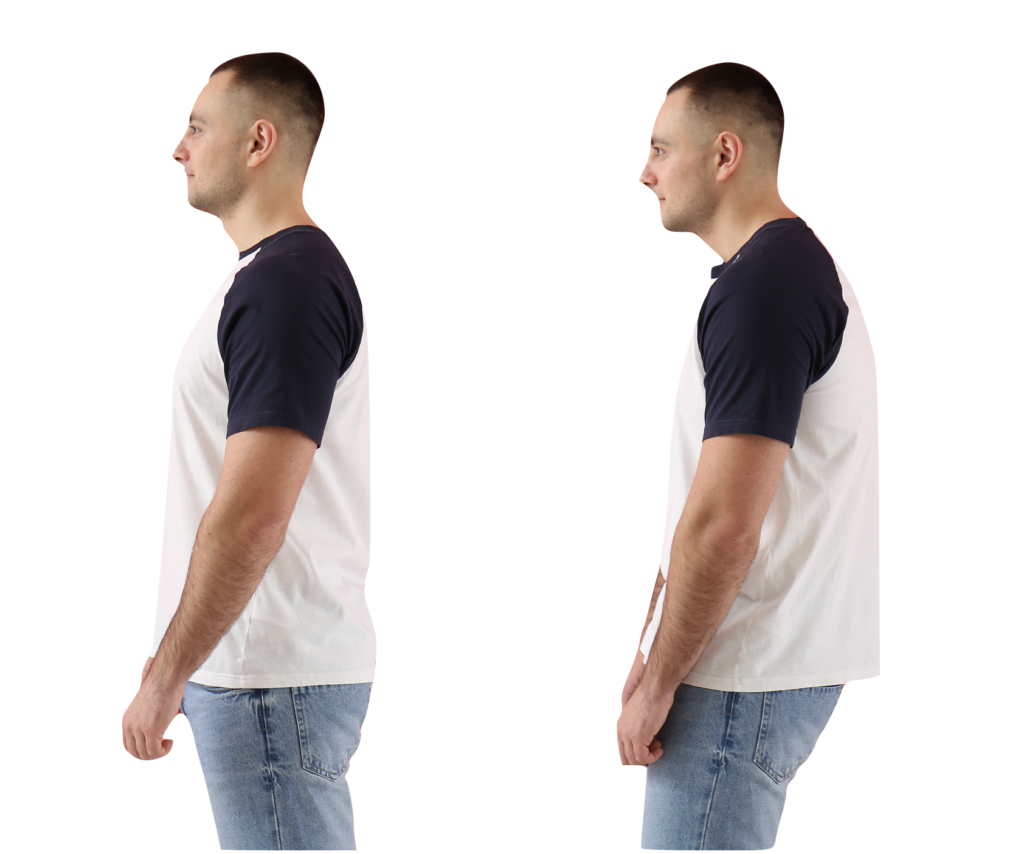 Man with head posture correction side view.