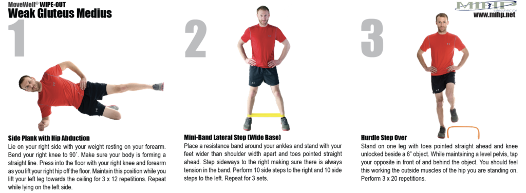 Gluteus medius strengthening exercises demonstration.