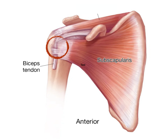 Diagram of shoulder anatomy highlighting subscapularis muscle